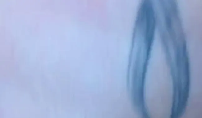 Ausritt auf dem Hocker Teil 2